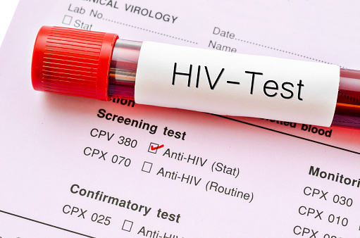 HIV test: «Aσπίδα» προστασίας για τους δημότες κατά της σοβαρής νόσου HIV test: «Aσπίδα» προστασίας για τους δημότες κατά της σοβαρής νόσου