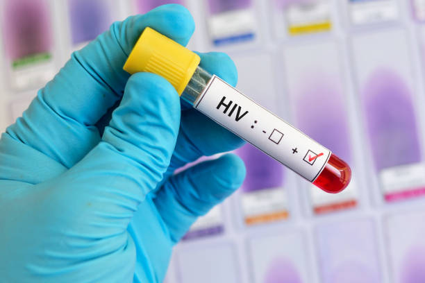 ΟΗΕ: Το AIDS μπορεί να εξαλειφθεί μέχρι το 2030 με επενδύσεις στην πρόληψη και τη θεραπεία ΟΗΕ: Το AIDS μπορεί να εξαλειφθεί μέχρι το 2030 με επενδύσεις στην πρόληψη και τη θεραπεία