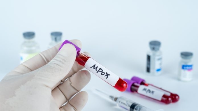 Ιορδανία: Εντοπίστηκε κρούσμα mpox-ευλογιάς των πιθήκων Ιορδανία: Εντοπίστηκε κρούσμα mpox-ευλογιάς των πιθήκων